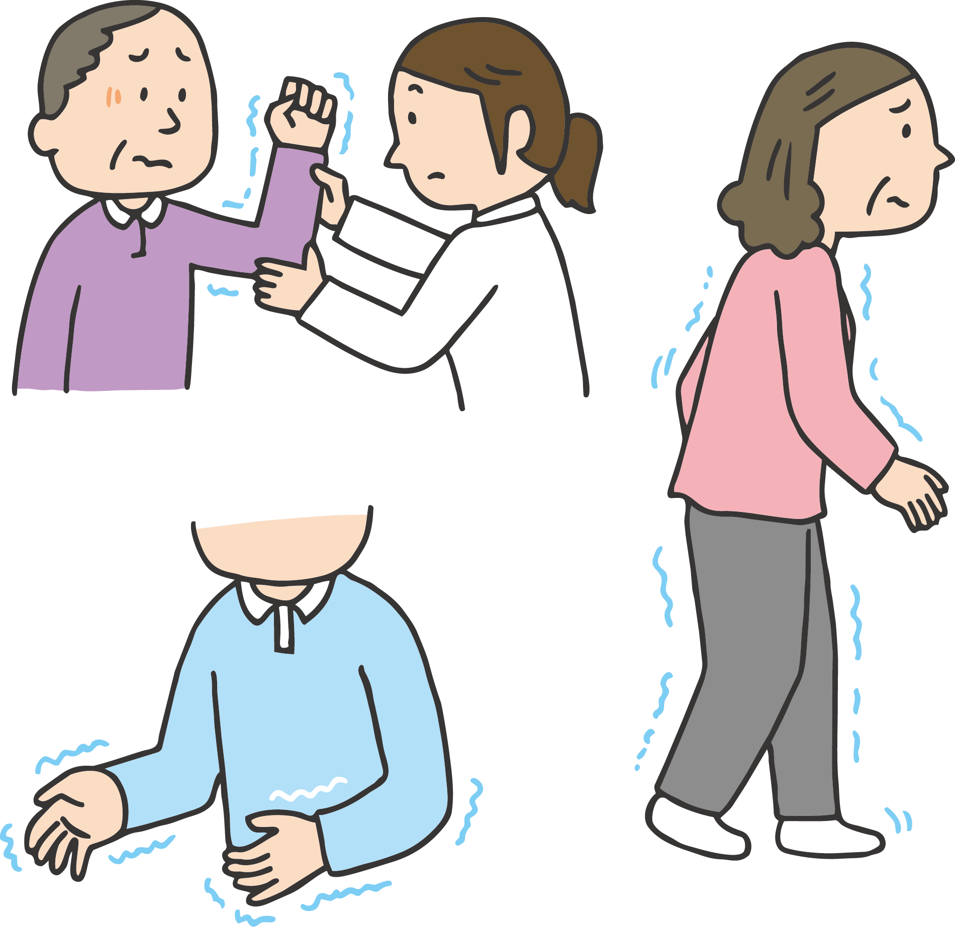 図1 PDの運動症状